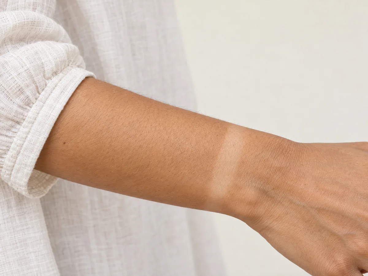 Skin Whitening Treatment in Jaipur: Tan removal treatment, Tan removal, close-up on Indian skin, assessed | AI Aesthetics, C-Scheme
