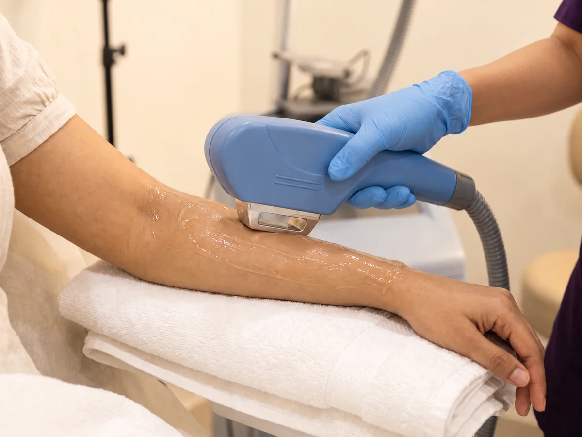 Bikini Laser Hair Removal in Jaipur: Coverage beyond the bikini area, Half Arms laser hair removal | AI Aesthetics, C-Scheme