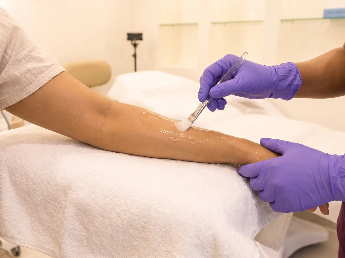Skin Whitening Treatment in Jaipur: Whitening and de-tan peels: from ₹2,500, Detan Peel | AI Aesthetics, C-Scheme
