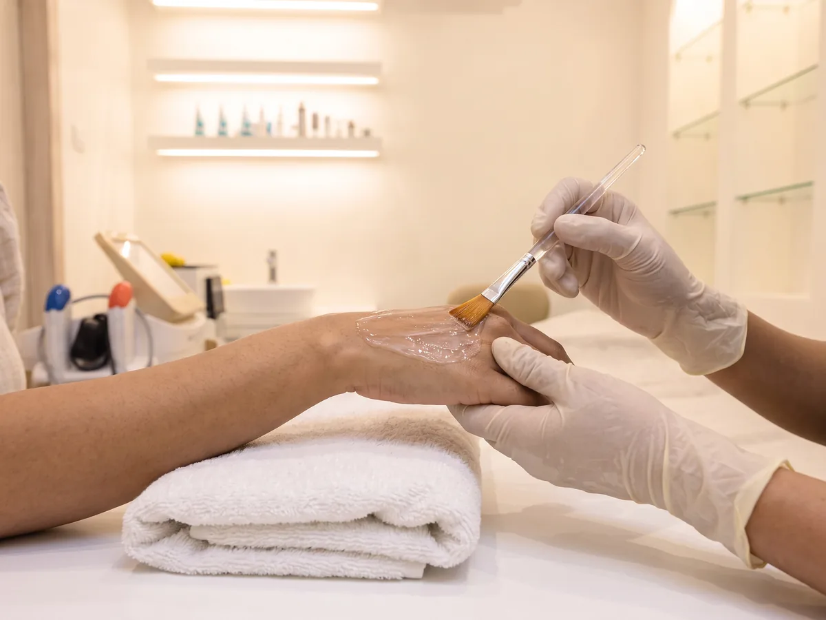 Chemical Peel Jaipur: Hand Rejuvenation Peel | AI Aesthetics, C-Scheme