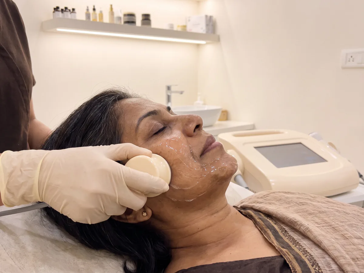 RF Skin Tightening Jaipur: 7. RF energy delivery, Rf step | AI Aesthetics, C-Scheme