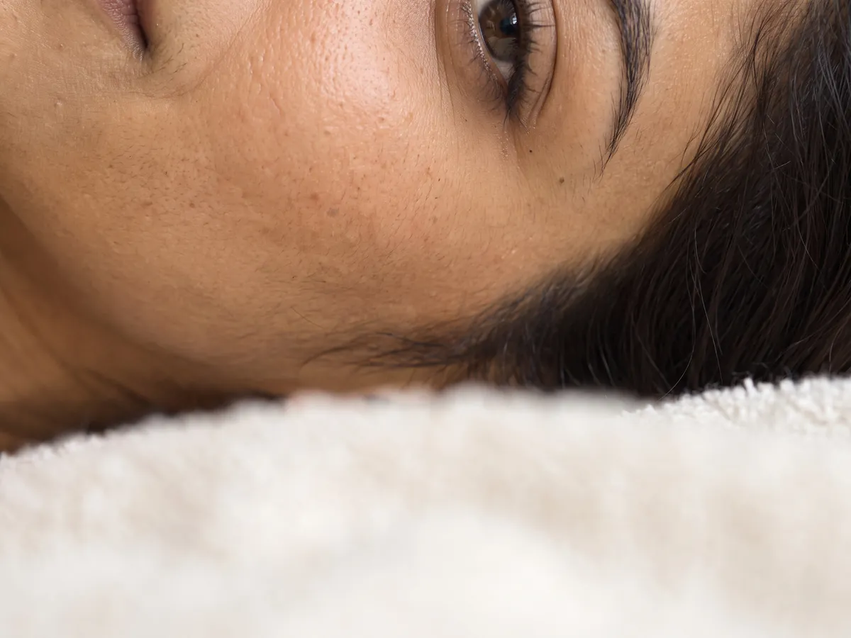 Skin Whitening Treatment in Jaipur: Your natural skin colour is genetic and beautiful as it is; treatment, Brightness: even, luminous | AI Aesthetics, C-Scheme