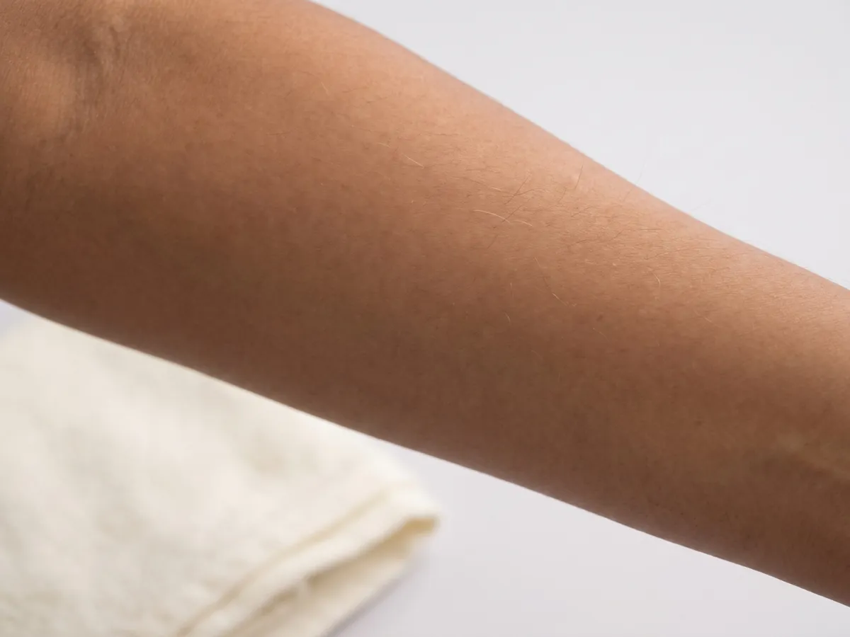 Face Laser Hair Removal Jaipur: Finer hair: facial hair is often thinner and lighter than underarm or, Finer hair: a woman's forearm | AI Aesthetics, C-Scheme