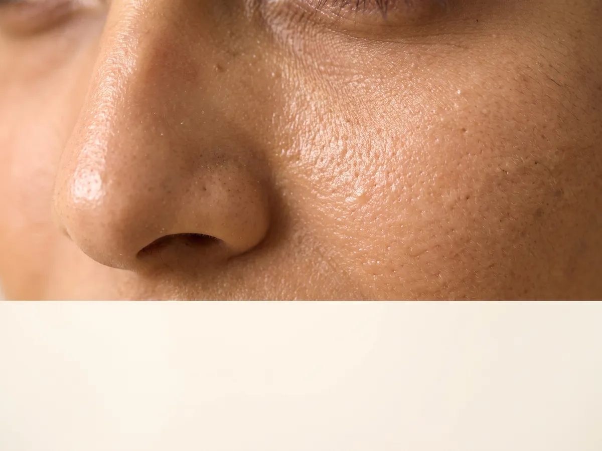 Chest, Back & Stomach Laser Hair Removal in Jaipur: Skip lotion, oil and body spray on the area on the day, Oily skin: t-zone shine | AI Aesthetics, C-Scheme