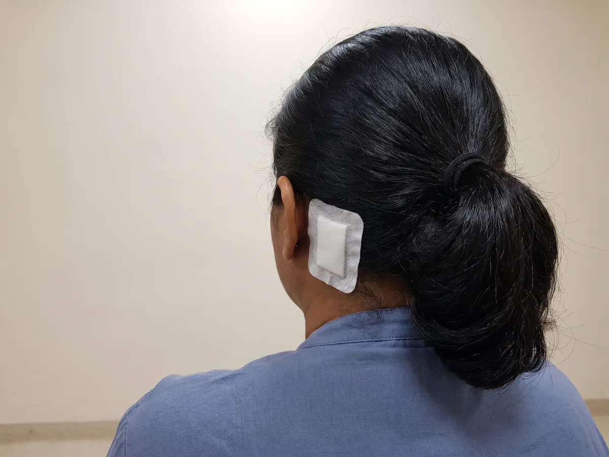 Double Chin Treatment Jaipur: Interest in non-surgical tightening, Recent surgery: a small clean dressing near the hairline | AI Aesthetics, C-Scheme