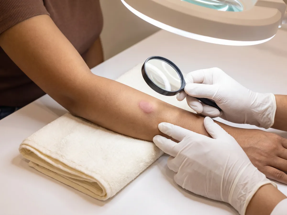 Beard Shaping Laser Jaipur: Avoid treatment if there is active infection or open wounds, Active skin infection: a dermatologist | AI Aesthetics, C-Scheme
