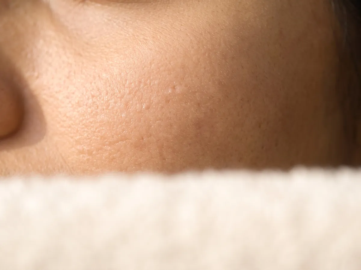 Skin Whitening Treatment Jaipur: Underarms: shaving and waxing often darken the skin, and laser hair, Smooth texture: macro of | AI Aesthetics, C-Scheme
