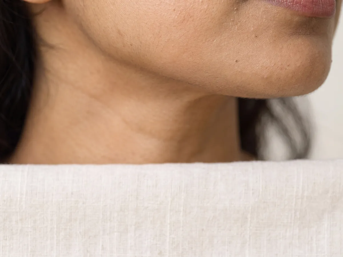Facials Jaipur: Uneven skin tone, Uneven tone: jaw-to-neck tone difference in daylight | AI Aesthetics, C-Scheme