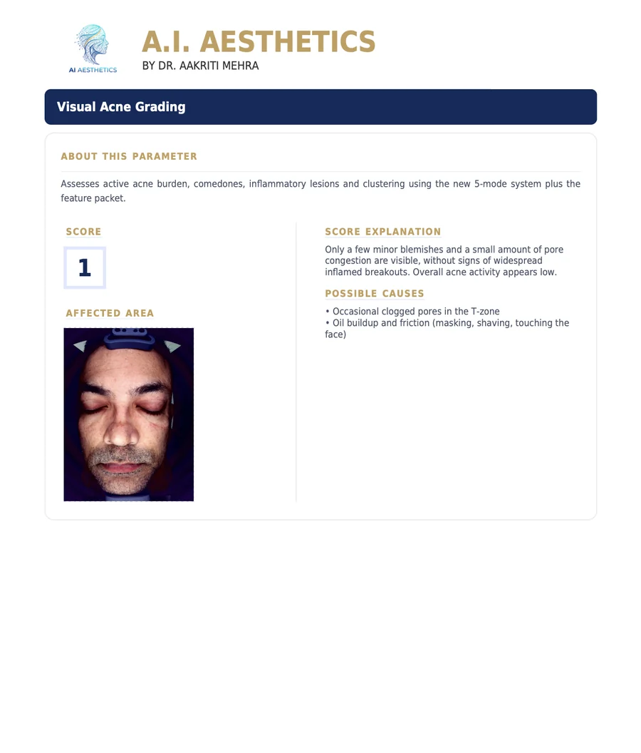 Sample AI Aesthetics skin analysis report — Visual Acne Grading