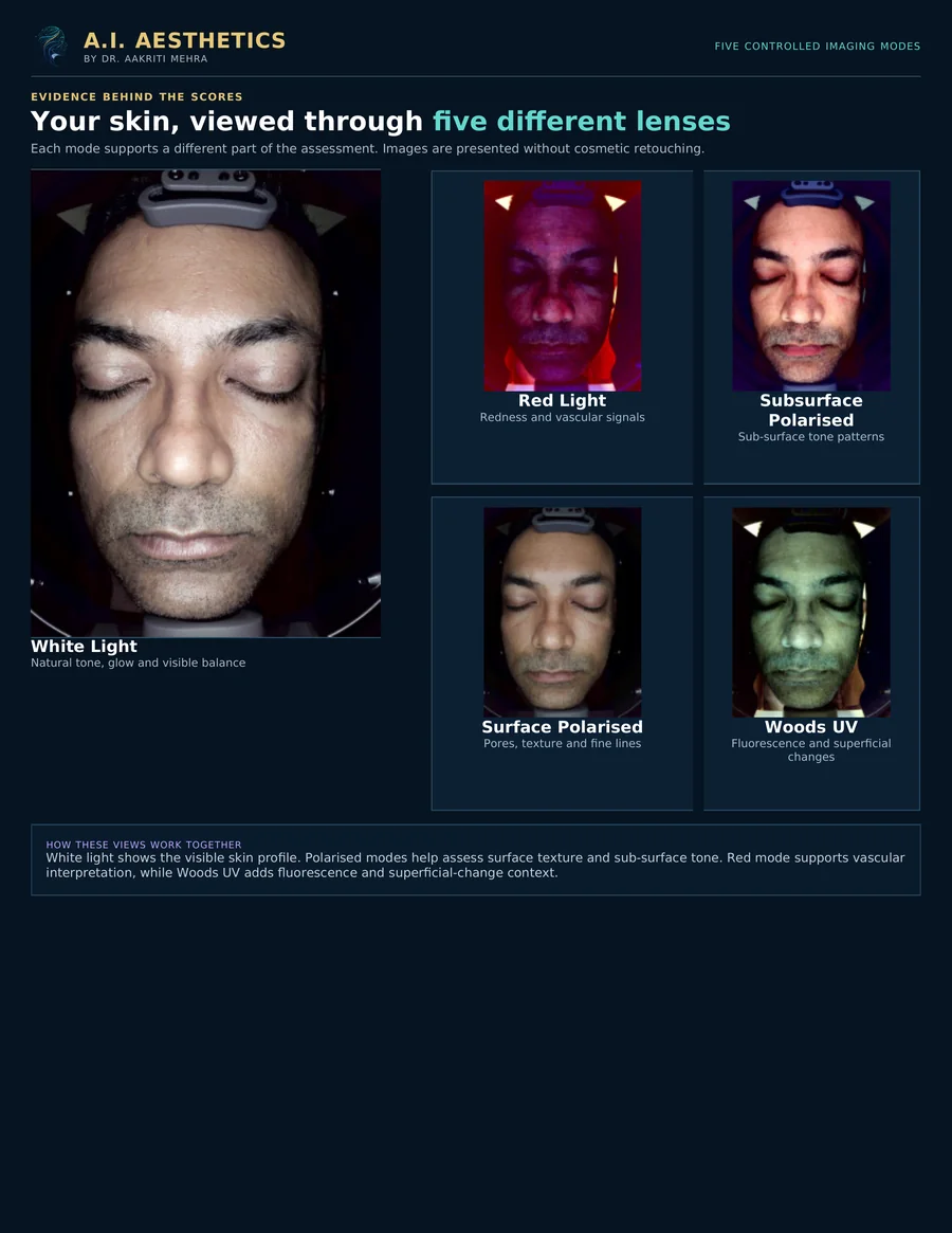 AI Customized Facial in Jaipur: Five imaging lenses, Sample AI Skin Passport diagnostic report page | AI Aesthetics, C-Scheme